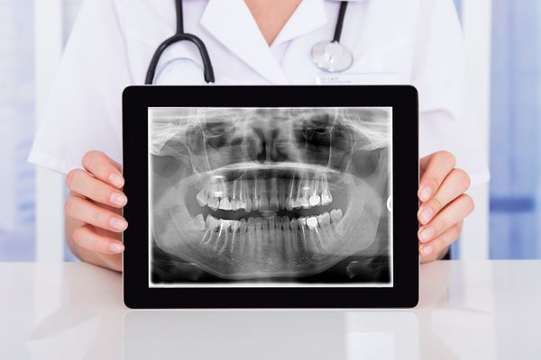 DVT 3D Diagnostik